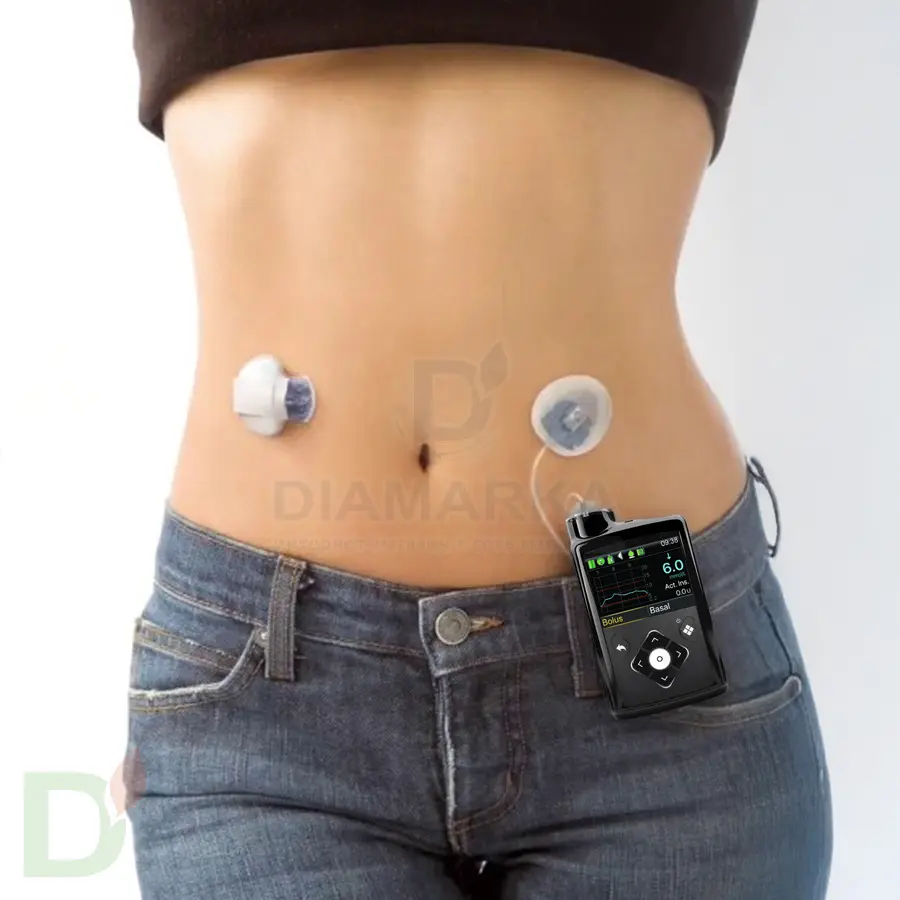 Инсулиновая помпа Medtronic MiniMed 720G MMT-1859 по программе обмена (Trade In)